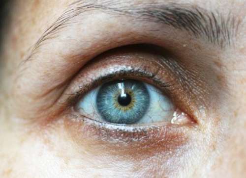 از علت تا درمان خشکی چشم در زنان یائسه