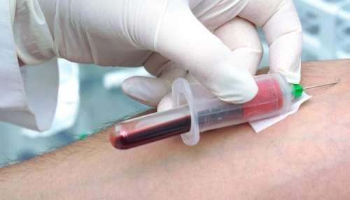 آزمایش خون | تفسیر و خواندن آزمایش خون و معنی حروف انگلیسی آزمایش خون
