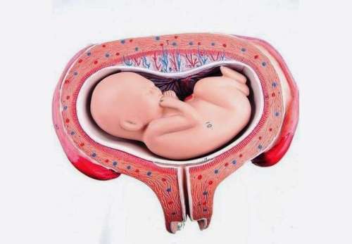 جنین عرضی چیست و چه علائمی دارد ؟