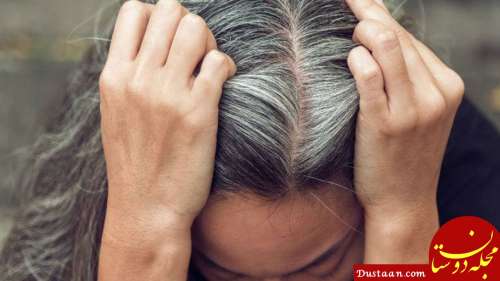 درمان های خانگی برای سیاه کردن مو و جلوگیری از سفید شدن مو