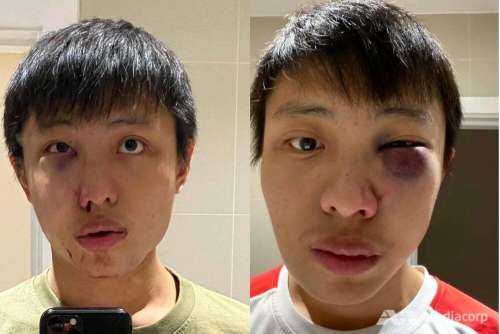 حمله به دانشجوی سنگاپوری در لندن بخاطر کرونا/ عکس