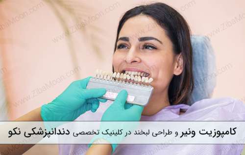 کامپوزیت ونیر و طراحی لبخند در کلینیک تخصصی دندانپزشکی نکو
