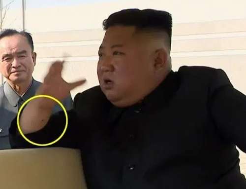 ببینید | راز جای سوزن روی دست رهبر کره شمالی چیست؟