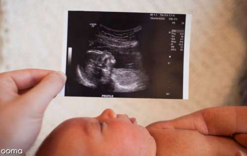 عکس جنین پسر در سونوگرافی