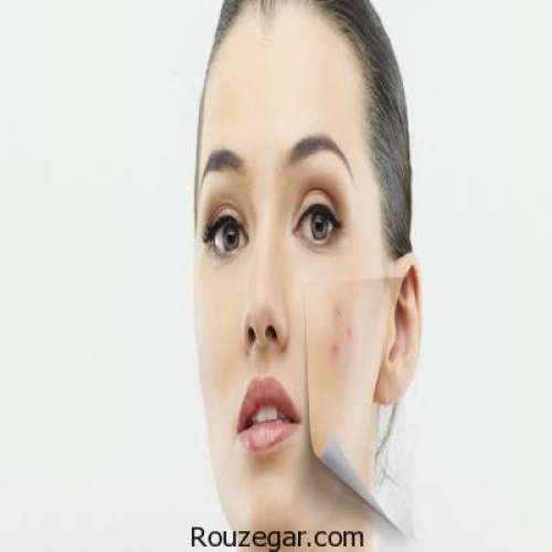 ماسک های خانگی برای درمان لکه های پوستی و شفافیت پوست