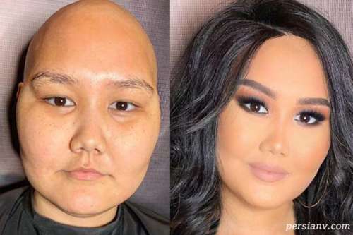 عکس قبل و بعد میکاپ روی صورت های آسیب دیده