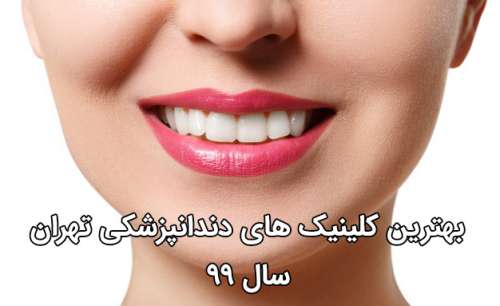 10 بهترین کلینیک دندانپزشکی تهران ، مراکز برتر سال 99