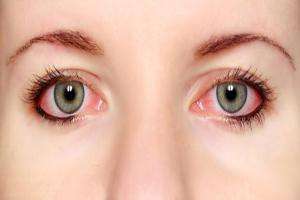 علت التهاب چشم و درمان آن