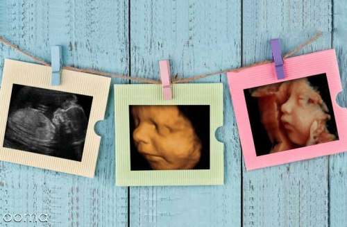 8 سوال رایج در سونوگرافی حاملگی