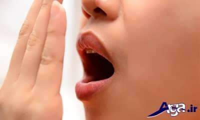 درمان بوی بد دهان با سیزده روش خانگی فوق العاده