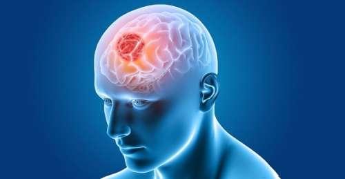 بررسی علائم و درمان بیماری های رایج مغزی