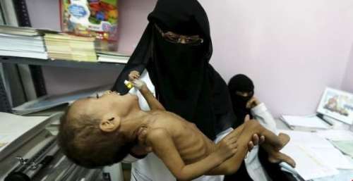 هشدار سازمان ملل نسبت به گرسنگی و مرگ هزاران یمنی