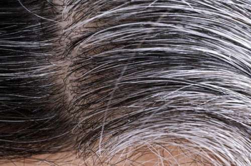 درمان و رفع سفیدی مو