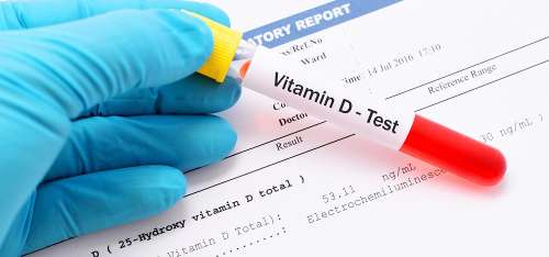 آزمایش ویتامین دی: همه چیز درباره تست ویتامین D و تفسیر آن