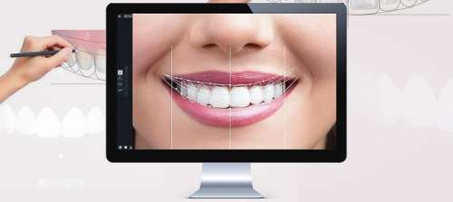 بهترین خدمات دندانپزشکی برای اصلاح طرح لبخند چیست ؟