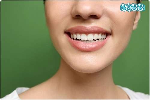 نوار سفید کننده دندان چیست؟