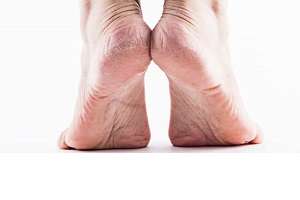 ترک و خشکی کف پا به خاطر کمبود ویتامین B3