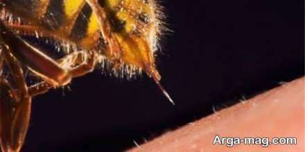 درمان زنبور گزیدگی با روش های خانگی با تاثیر سریع