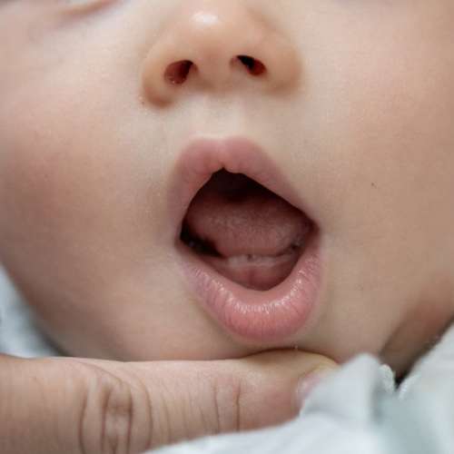 آفت دهان کودک :علل ، علایم و راههای درمتن