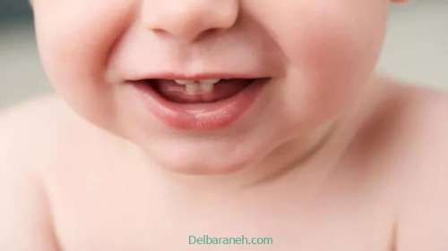 راهکار های کاهش ناراحتی و درد هنگام دندان درآوردن نوزاد