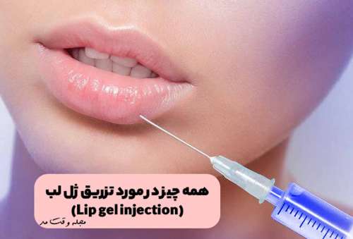 تزریق ژل لب (Lip gel injection)، مراقبت، فواید، عوارض، هزینه، انواع روش تزریق ژل لب و فیلر لب