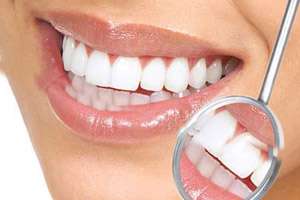 انواع روشهای دندانپزشکی زیبایی، روکش، کامپوزیت، لمینت، ایمپلنت و ارتودنسی