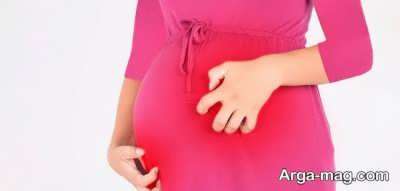 درمان کلستاز در بارداری و نشانه های بروز این بیماری