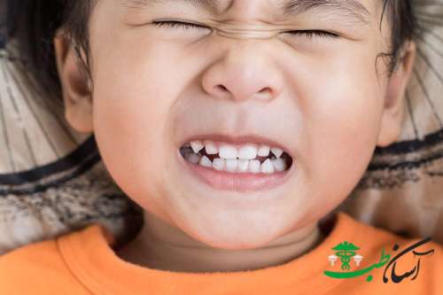 علت دندان قروچه کودکان چیست؟ + روش درمان