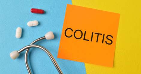 کولیت اولسراتیو چیست؟ + علائم کولیت روده
