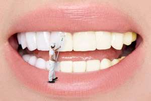 6 راه ساده و موثر برای سفید کردن دندان ها