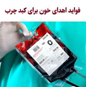خواص و فواید اهدای خون برای کبد چرب