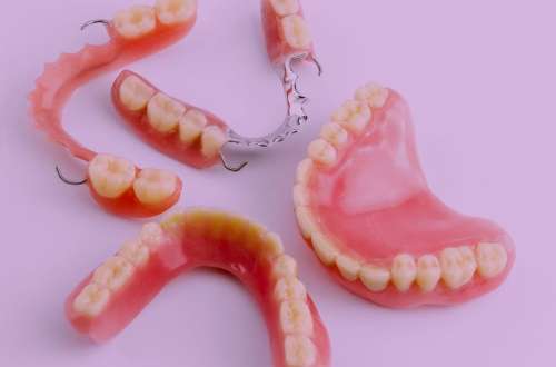 پروتز دندان چیست؟ چطور انجام می شود و ماندگاری آن چقدر است؟
