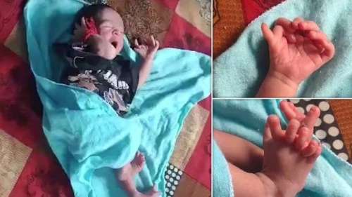 تولد نوزادی با ۲۶ انگشت که خانواده اش او را تناسخ یک الهه هندو می‌دانند