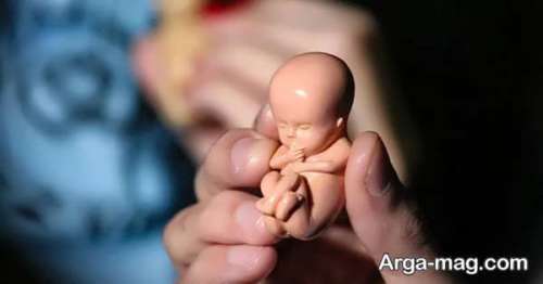 عوامل مؤثر بر سقط جنین را بشناسیم