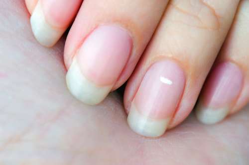 آیا می‌ دانید که علت به وجود آمدن لکه‌ های سفید روی ناخن هایتان چیست؟