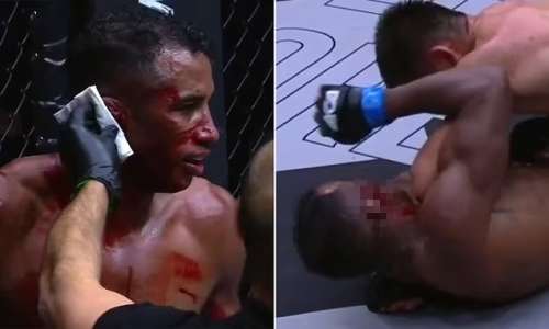 ترکیدن گوش مبارز MMA در اثر ضربه مشت حریف که به مبارزه پایان داد + ویدیو