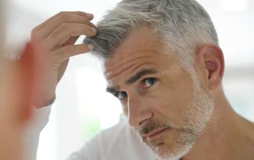 چرا در سنین پایین موهای سرمان سفید می‌شود؟