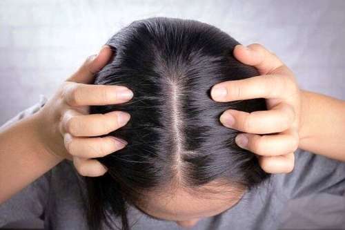 چرا موهایمان زود چرب می شود؟ | تنها راه جلوگیری از چربی مو