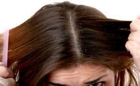 درمان قطعی شپش موی سر با سس مایونز