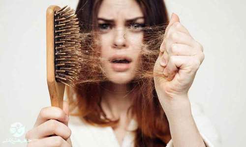 این موارد سبب ریزش موهایتان می شود | برای جلوگیری از ریزش مو این کار ها را انجام دهید