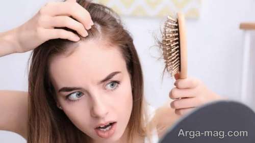 تقویت موهای جلوی سر با انواع روش های طبیعی و دارویی