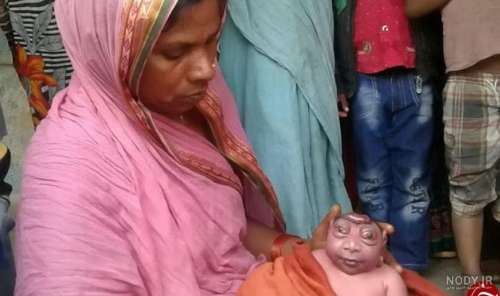 عکس نوزاد عجیب الخلقه در هند