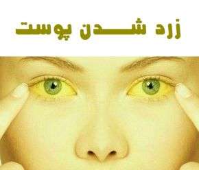 علت اصلی زرد شدن پوست صورت و نحوه تشخیص آن