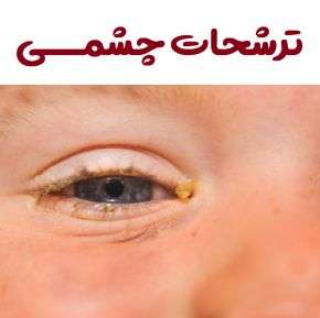 علت ترشحات سفید چشم و نحوه درمان قی چشم