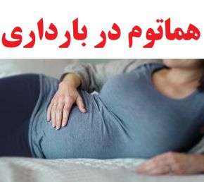 علت و علائم سابکرونیک یا هماتوم در بارداری + درمان