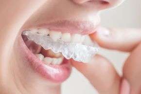 ارتودنسی نامرئی دندان + مزایا و معایب