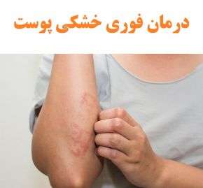 درمان فوری خشکی پوست دست ، پا و صورت در طب سنتی