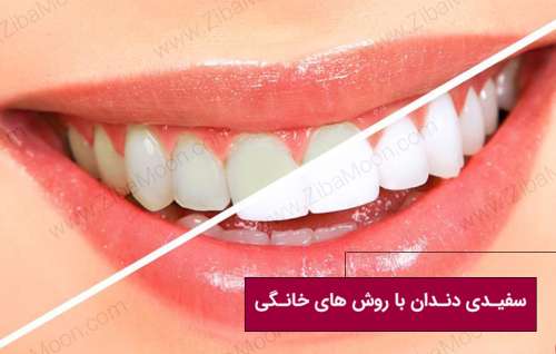 سفیدی دندان با روش های خانگی