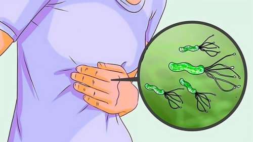 هلیکوباکتر پیلوری: هر آنچه درباره علائم ابتلا به باکتری و درمان طبیعی آن باید بدانید