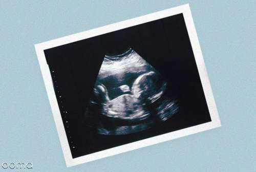 آیا سونوگرافی واژینال در بارداری خطرناک است؟